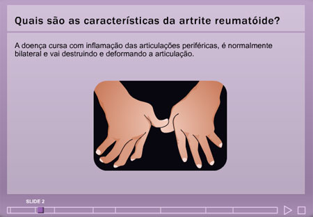 Video Aula Artrite Reumatóide